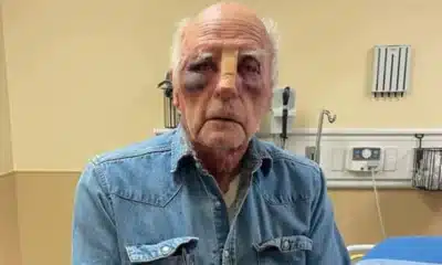 man beaten