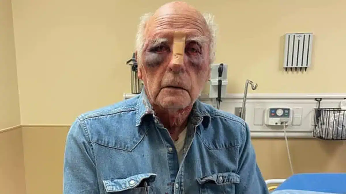 man beaten