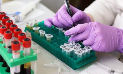 medical testing